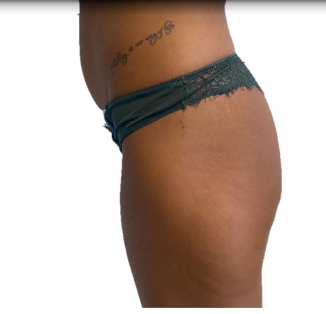 Before image-11