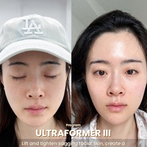 Before & After